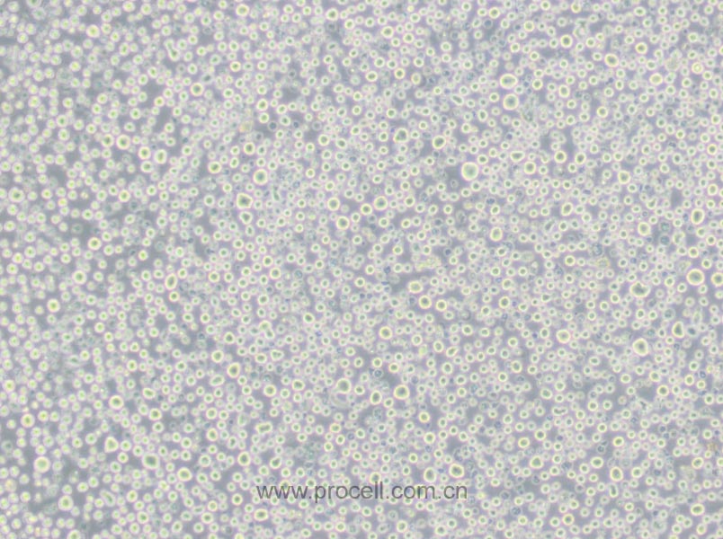 U266 (人多发性骨髓瘤细胞) (STR鉴定正确)
