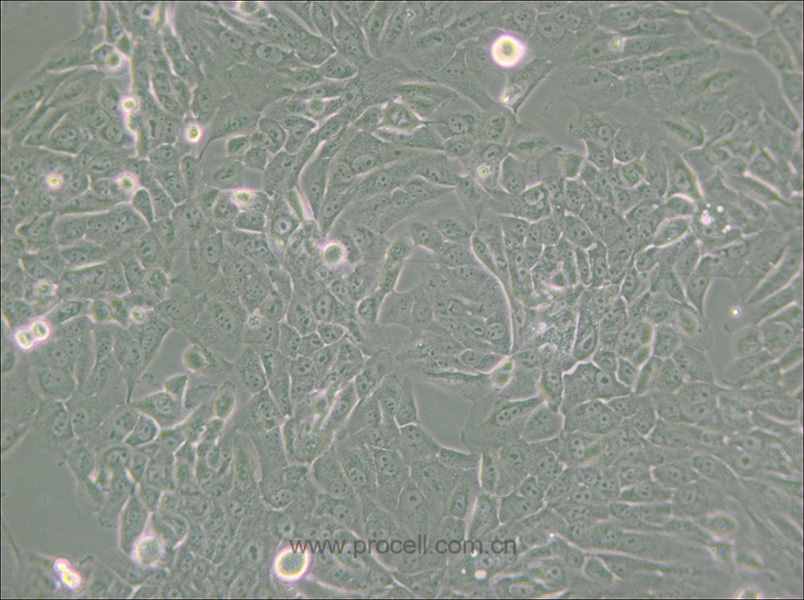 MCF 10A (人正常乳腺上皮细胞) (STR鉴定正确)