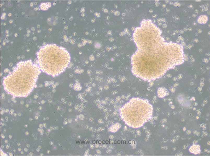NK-92 (人恶性非霍奇金淋巴瘤患者的自然杀伤细胞) (STR鉴定正确)