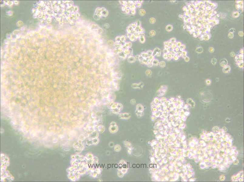 NK-92MI (人恶性非霍奇金淋巴瘤患者的自然杀伤细胞) (STR鉴定正确)