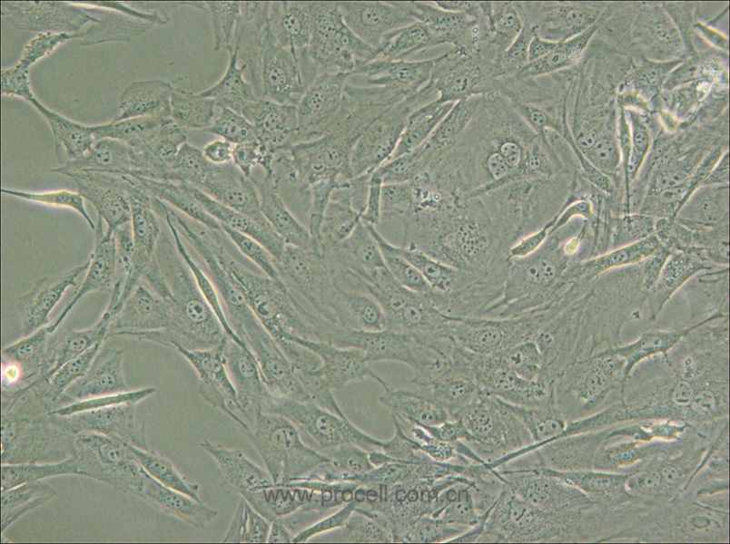 3T3-Swiss albino (小鼠胚胎成纤维细胞) (STR鉴定正确)