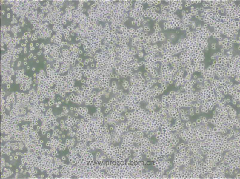 OKT 3 (小鼠杂交瘤细胞(抗CD3))