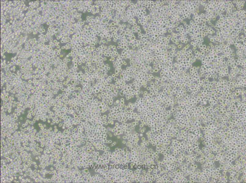 OKT 3 (小鼠杂交瘤细胞(抗CD3))(种属鉴定正确)