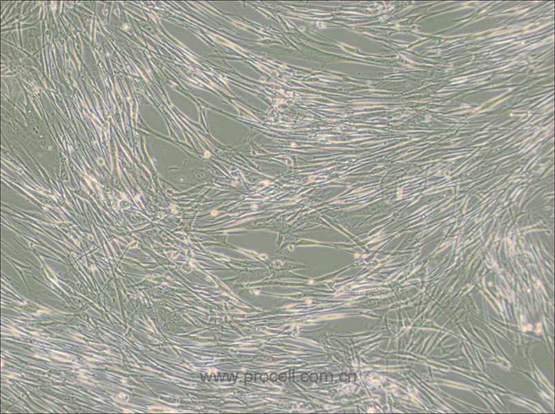 IMR-90 (人胚肺成纤维细胞) (STR鉴定正确) (暂不出售)