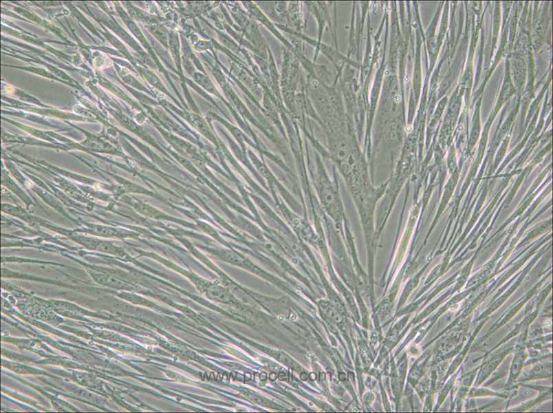IMR-90 (人胚肺成纤维细胞)(STR鉴定正确)