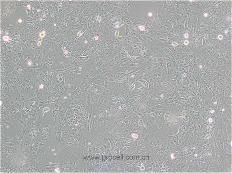 LX-2 (人肝星形细胞) (STR鉴定正确)