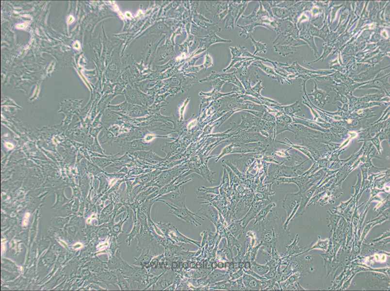 TtT/GF (小鼠垂体促甲状腺滤泡星状细胞) (种属鉴定正确)