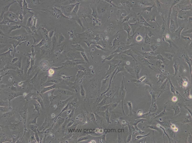 HULEC-5a (人肺微血管内皮细胞) (STR鉴定正确)(暂不出售）