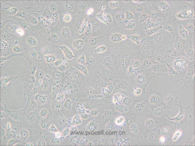 MARC-145 [Marc-145; Marc 145; Marc145] (非洲绿猴胚胎肾细胞)(种属鉴定正确)