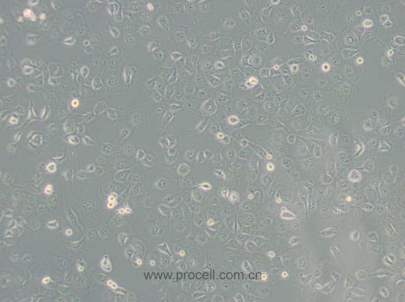 MARC-145 [Marc-145; Marc 145; Marc145] (非洲绿猴胚胎肾细胞)(种属鉴定正确)