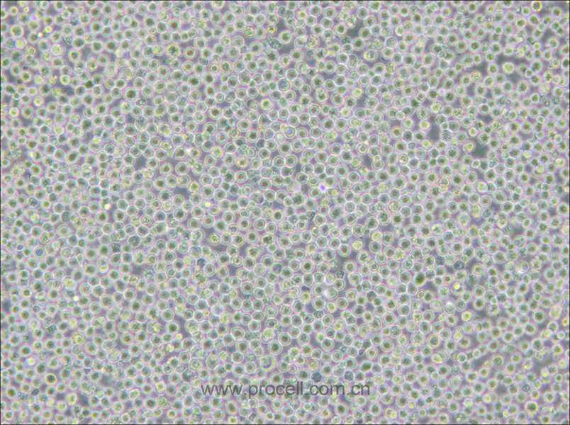 MV-4-11 (人髓性单核细胞白血病细胞) (STR鉴定正确)