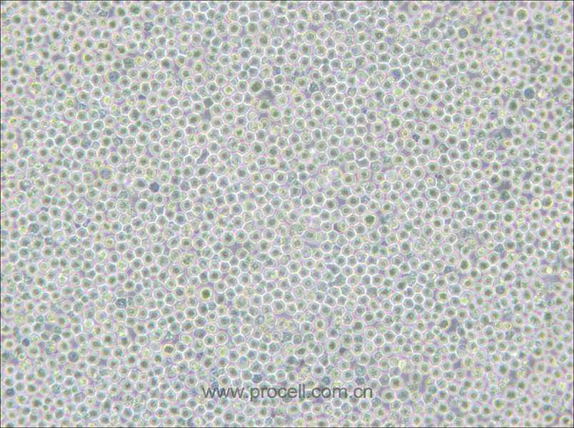MV-4-11 (人髓性单核细胞白血病细胞) (STR鉴定正确)