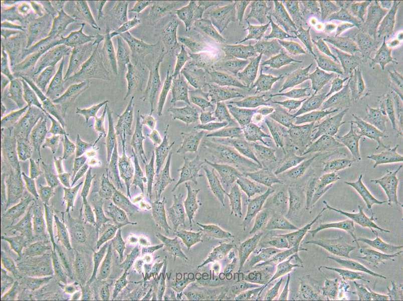 LN229 [LN-229; LNT-229] (人胶质母细胞瘤细胞) (STR鉴定正确)
