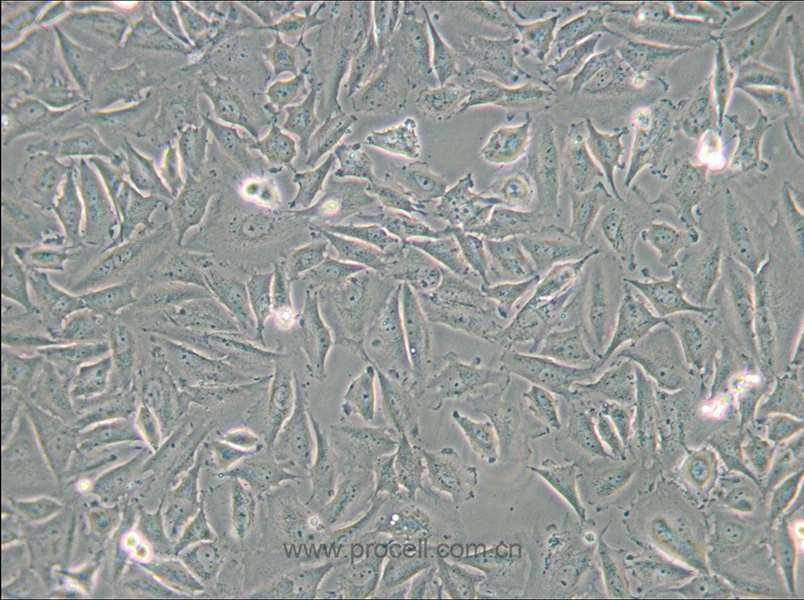 LN229 [LN-229; LNT-229] (人胶质母细胞瘤细胞) (STR鉴定正确)