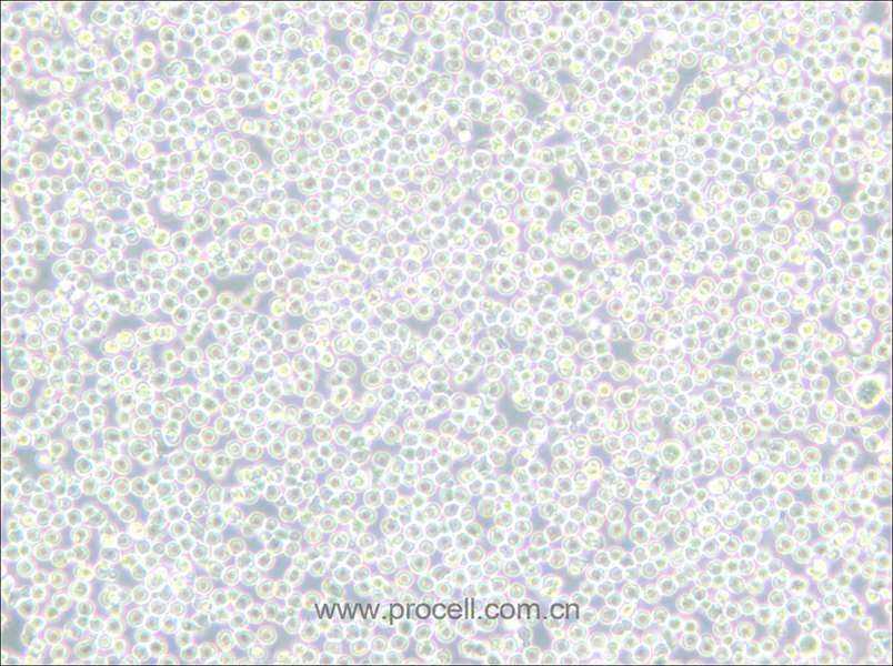 BALL-1 (人B淋巴细胞急性白血病) (STR鉴定正确)