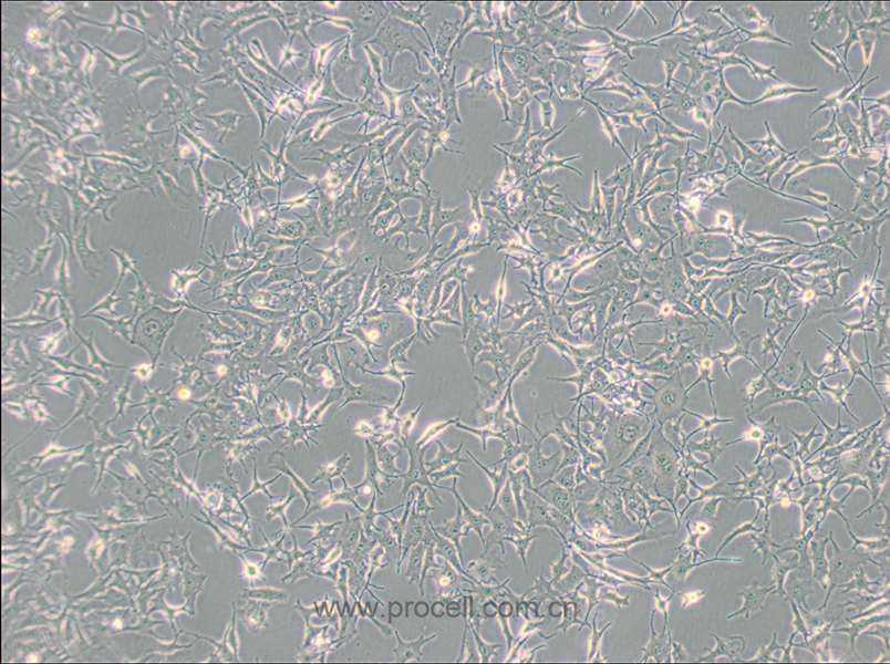 B16-F0 (小鼠黑色素瘤细胞) (STR鉴定正确)
