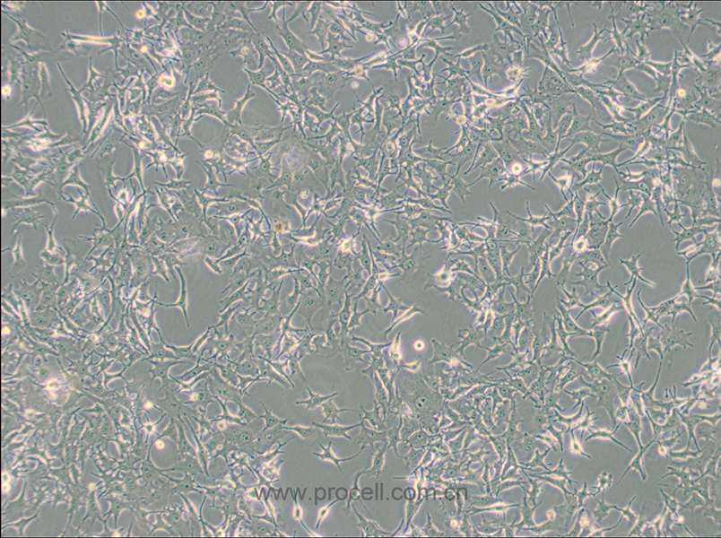 B16-F0 (小鼠黑色素瘤细胞) (STR鉴定正确)