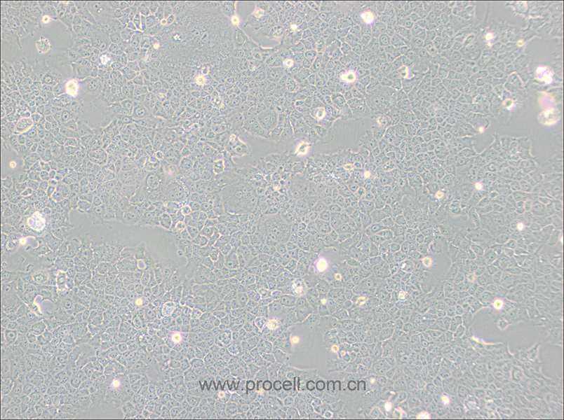 AML12 (小鼠正常肝细胞) (STR鉴定正确)