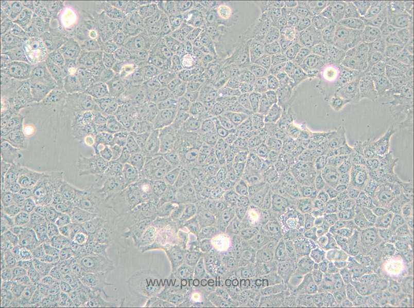 AML12 (小鼠正常肝细胞) (STR鉴定正确)