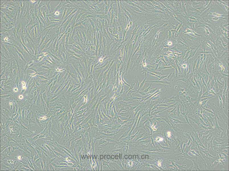 KGN (人卵巢颗粒细胞) (STR鉴定正确)