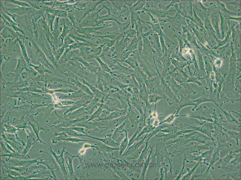 KGN (人卵巢颗粒细胞) (STR鉴定正确)