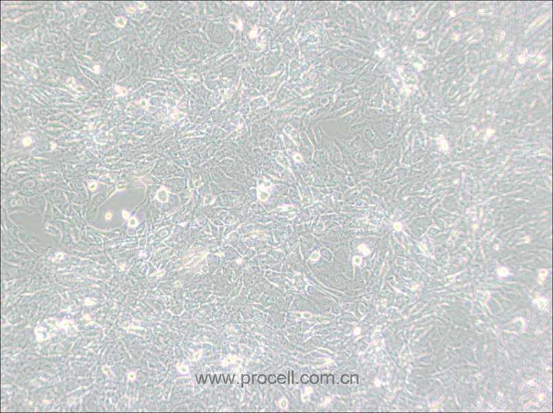 15P-1 (小鼠睾丸上皮细胞) (种属鉴定正确)