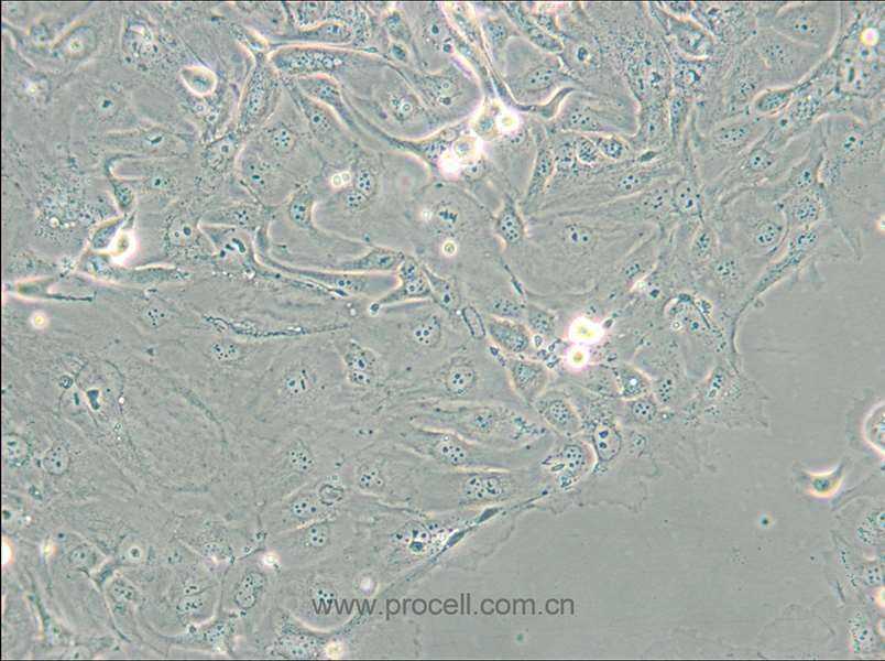 NCI-H2347 (人肺癌细胞) (STR鉴定正确)