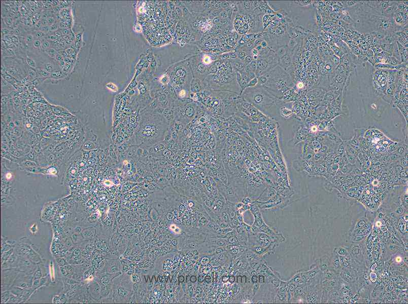 HPAF-II (人胰腺癌细胞) (STR鉴定正确)