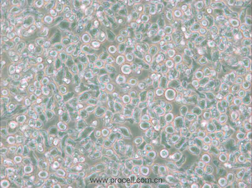MM.1S (人多发性骨髓瘤细胞) (STR鉴定正确)