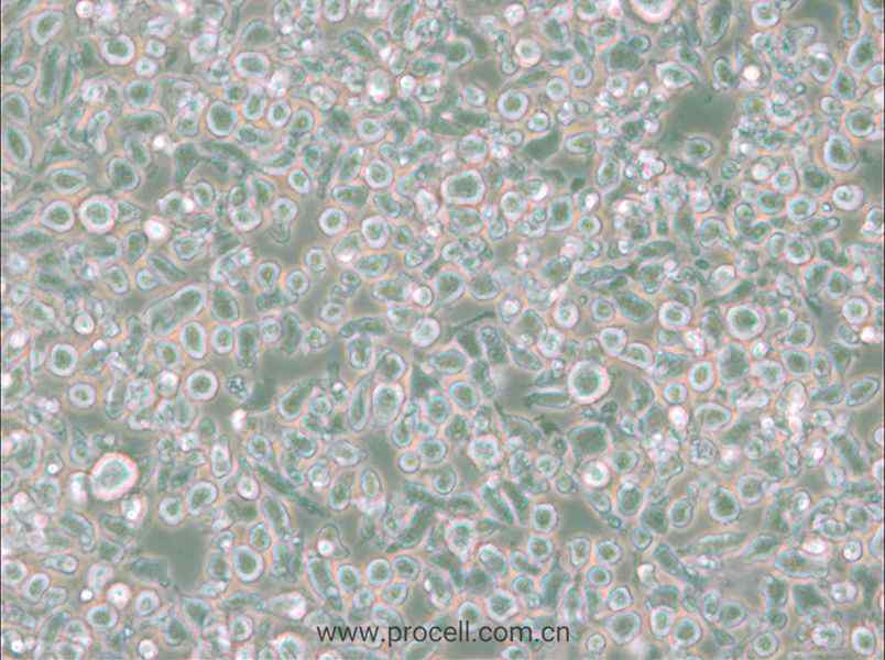 MM.1S (人多发性骨髓瘤细胞) (STR鉴定正确)