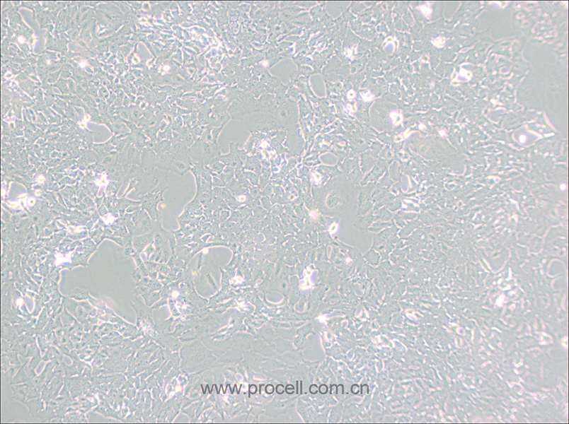 HC11 (小鼠乳腺上皮细胞) (种属鉴定正确)