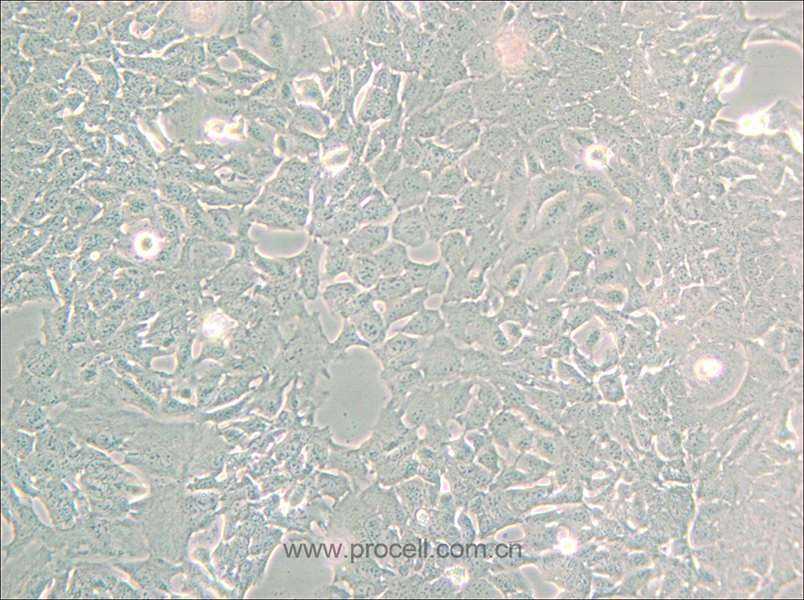 HC11 (小鼠乳腺上皮细胞) (种属鉴定正确)