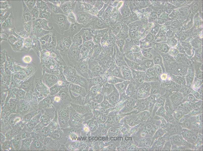 BHT101 (人甲状腺癌细胞(未分化)) (STR鉴定正确)