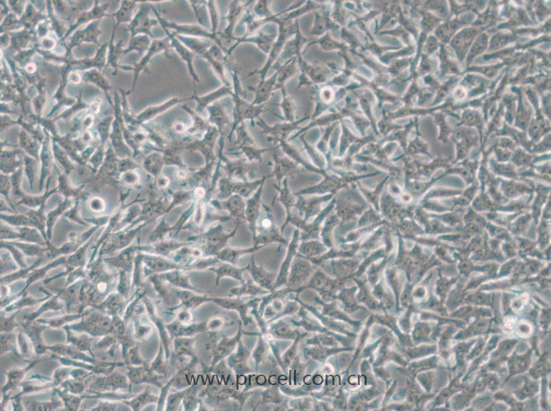 CAL-62 (人甲状腺癌细胞(未分化)) (STR鉴定正确)