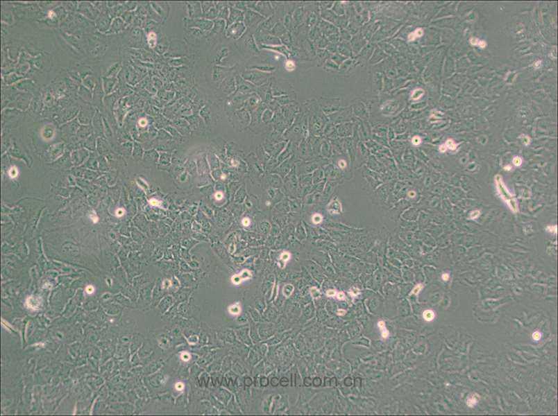 HMC3 (人小胶质细胞) (STR鉴定正确)