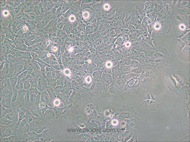 HMC3 (人小胶质细胞) (STR鉴定正确)