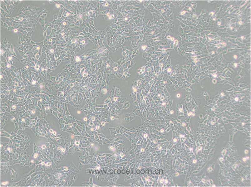 SK-N-AS (人神经母细胞瘤细胞) (STR鉴定正确)