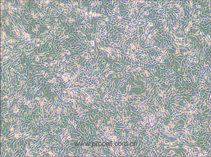 SUM159PT (人乳腺癌细胞系) (STR鉴定正确)