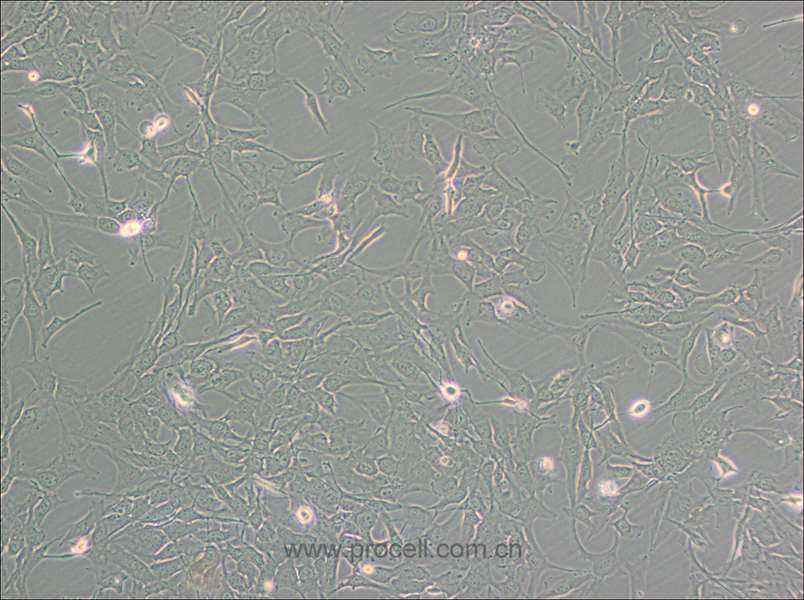KHM-5M (人甲状腺癌细胞(未分化)) (STR鉴定正确)