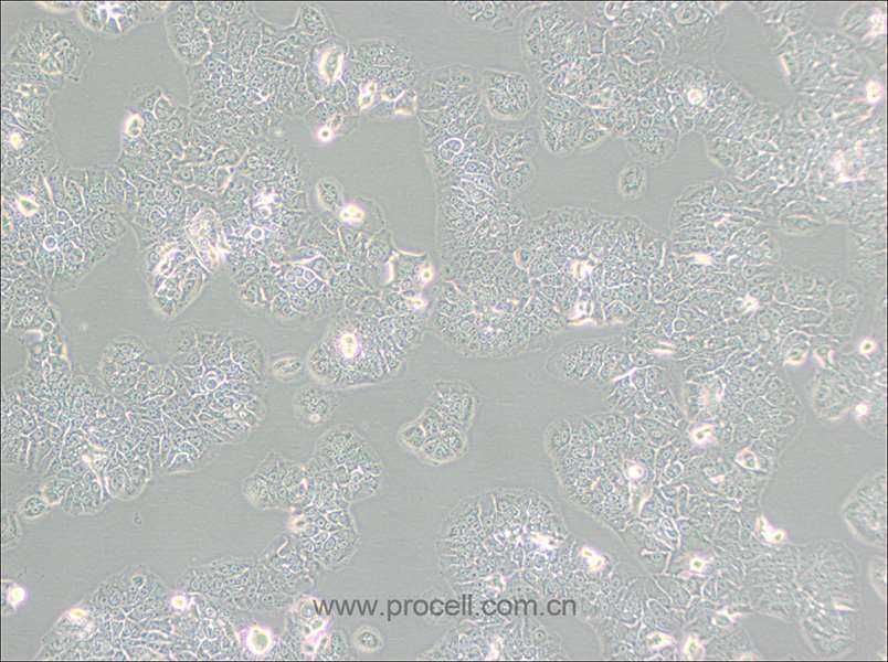 NCI-H1437 (人肺癌细胞) (STR鉴定正确)
