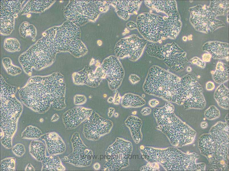 NCI-H1944 (人肺癌细胞) (STR鉴定正确)