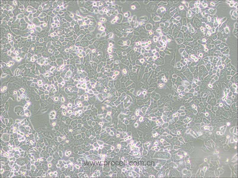 NCI-H2126 (人肺癌细胞) (STR鉴定正确)