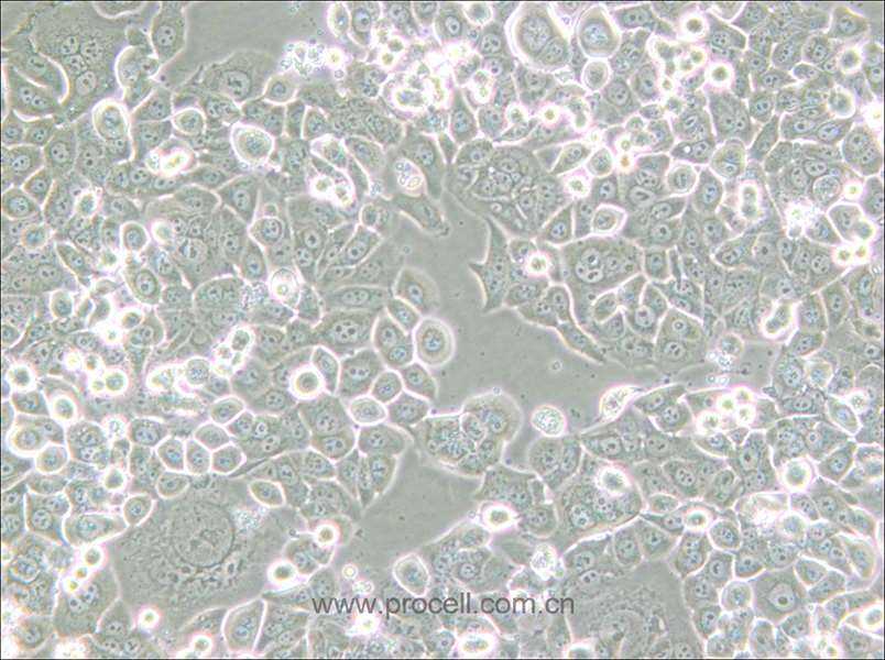 NCI-H2126 (人肺癌细胞) (STR鉴定正确)