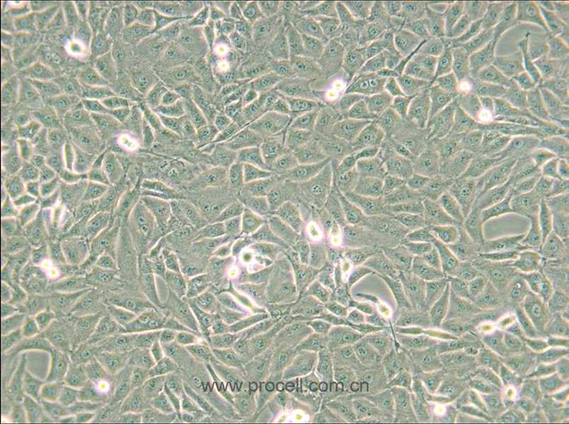 9L/lacZ (大鼠胶质肉瘤细胞) (种属鉴定正确)