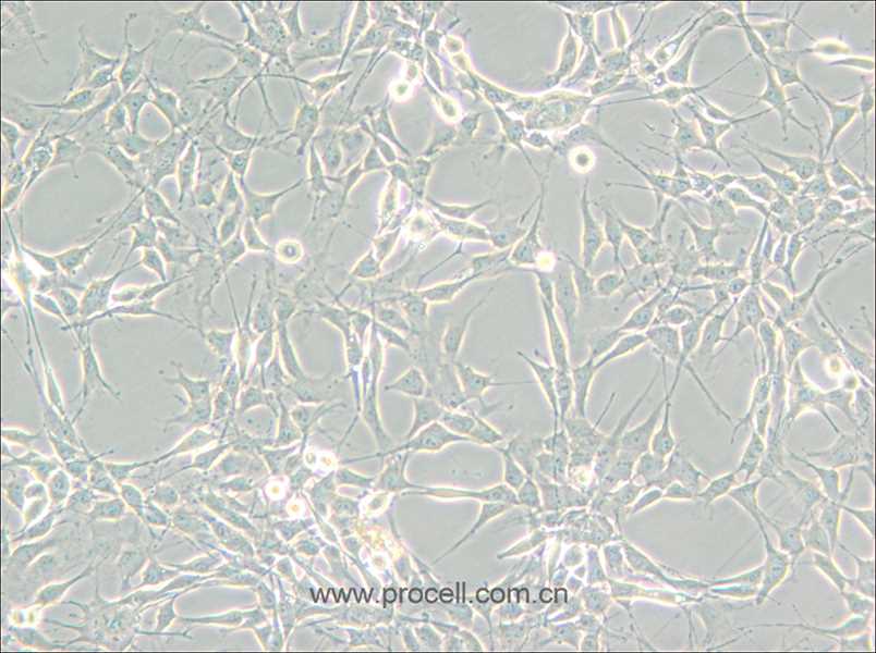 RG2 [D74] (大鼠胶质瘤细胞) (种属鉴定正确)