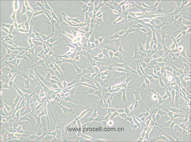 RG2 [D74] (大鼠胶质瘤细胞) (种属鉴定正确)