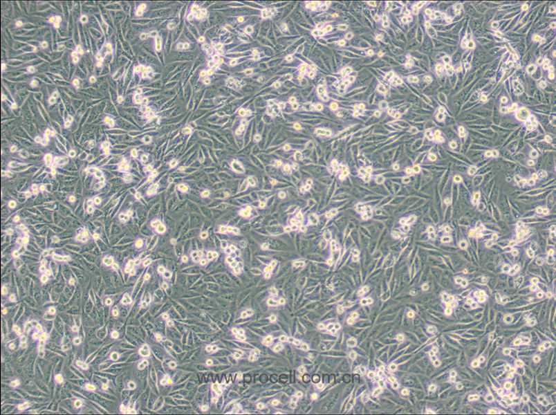 MDA-MB-231/GFP (人乳腺癌细胞(绿色荧光蛋白标记) (DMEM) (STR鉴定正确)