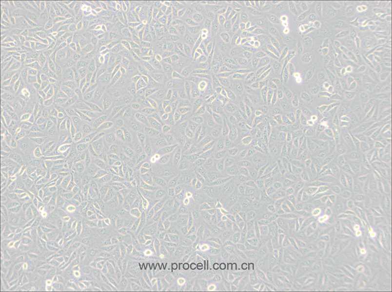 TPC-1 (人甲状腺癌细胞) (STR鉴定正确)