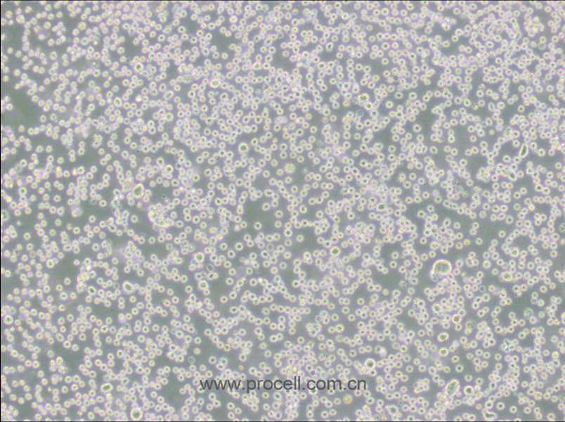 DB (弥漫大B细胞淋巴瘤细胞) (STR鉴定正确)