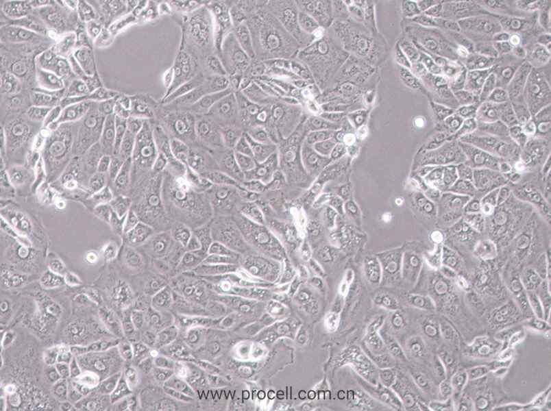 ACT-1 (人甲状腺癌细胞) (STR鉴定正确)